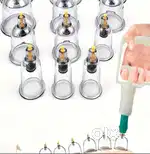 Cupping Therapy
