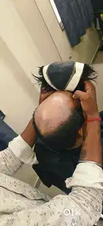 Hair patch technician
