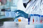Job profile QA and QC in Pharma company Vacancy Available in Panchkula