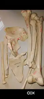 Bone set Unilateral