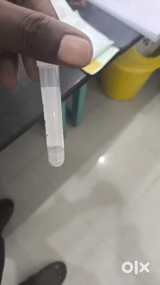 Blood sample collection from local labs to main lab